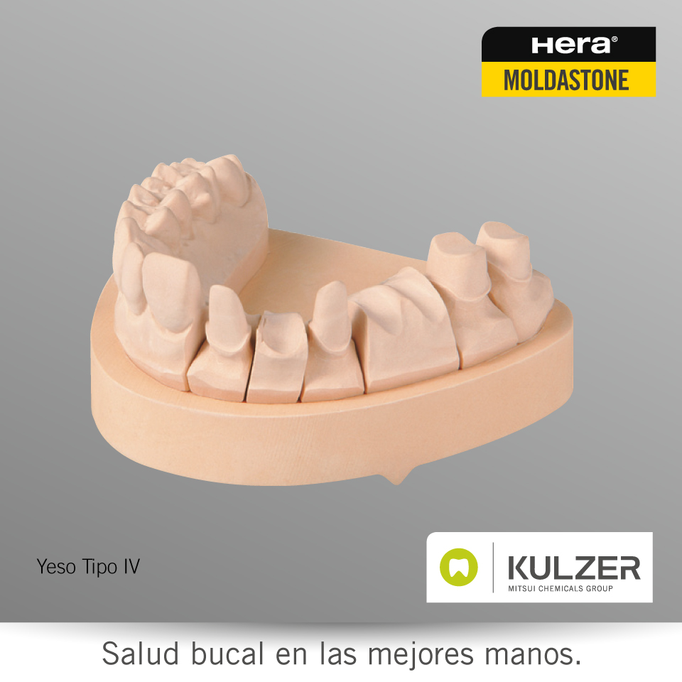 Requisitos para la obtención de modelos exactos al utilizar yesos dentales  – Kulzer México