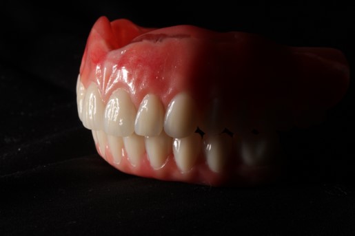 Dentadura completa superior con “protocolo” inferior con dientes Delara.
